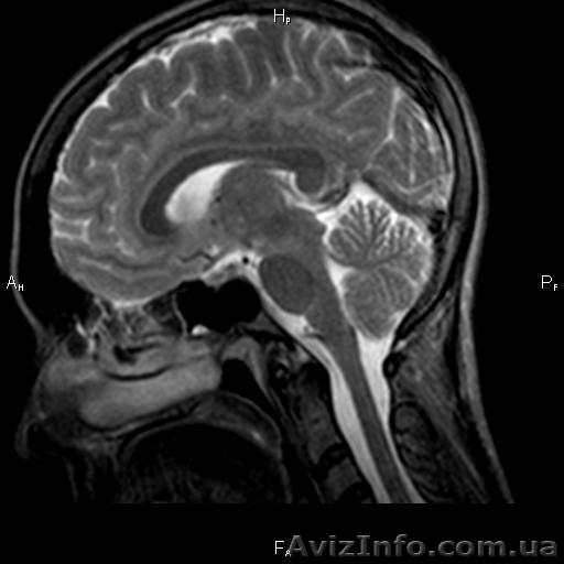 Медицинская диагностика, МРТ, КТ, Маммография, УЗИ - <ro>Изображение</ro><ru>Изображение</ru> #1, <ru>Объявление</ru> #9511