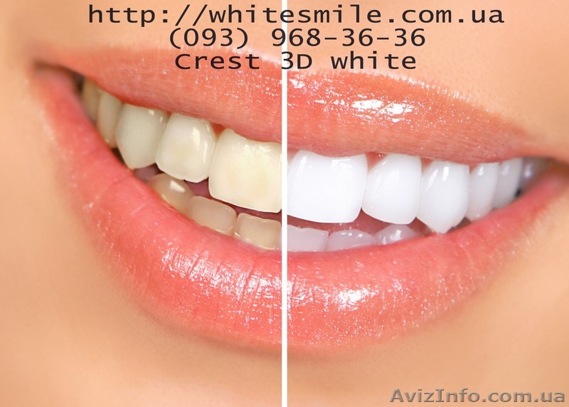 Полоски crest 3d white купить crest whitestrips Украина отзывы. - <ro>Изображение</ro><ru>Изображение</ru> #1, <ru>Объявление</ru> #622544