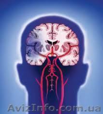 Вызов невропатолога на дом 200 грн - <ro>Изображение</ro><ru>Изображение</ru> #1, <ru>Объявление</ru> #670558