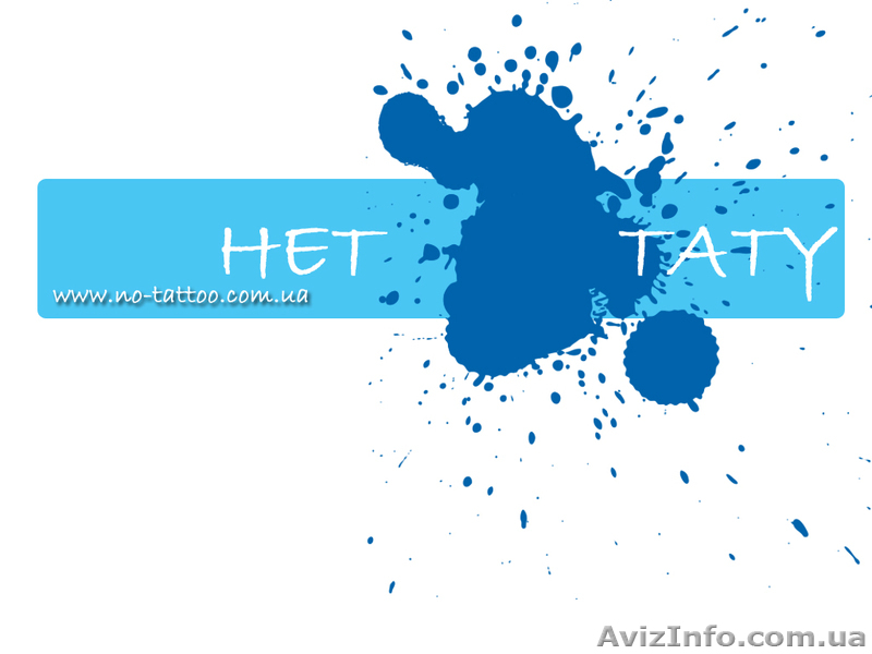 Удаление сосудов, пигментных пятен, татуировок и татуажа!  - <ro>Изображение</ro><ru>Изображение</ru> #1, <ru>Объявление</ru> #828521