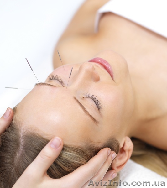 Лечение бессонницы иглоукалыванием - <ro>Изображение</ro><ru>Изображение</ru> #1, <ru>Объявление</ru> #837147