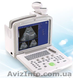 Портативный УЗИ сканер ФОР-220 м - <ro>Изображение</ro><ru>Изображение</ru> #1, <ru>Объявление</ru> #1125971