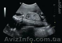 Ультразвукова система Logiq C5 Premium - <ro>Изображение</ro><ru>Изображение</ru> #1, <ru>Объявление</ru> #1120715