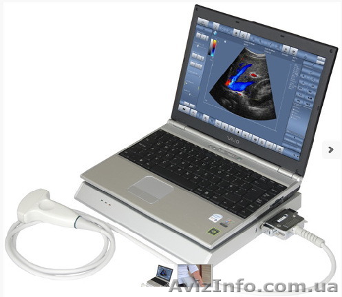 Цветной ультразвуковой сканер LS64 - <ro>Изображение</ro><ru>Изображение</ru> #1, <ru>Объявление</ru> #1116039