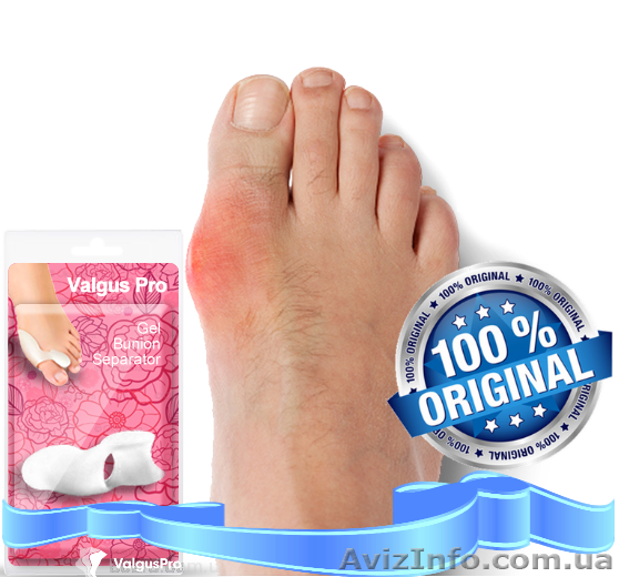 Косточки на ногах,  (Valgus Pro) - <ro>Изображение</ro><ru>Изображение</ru> #1, <ru>Объявление</ru> #1153008