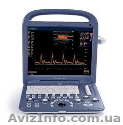 SonoScape S2 с компрессионной эластографией - <ro>Изображение</ro><ru>Изображение</ru> #1, <ru>Объявление</ru> #1146226