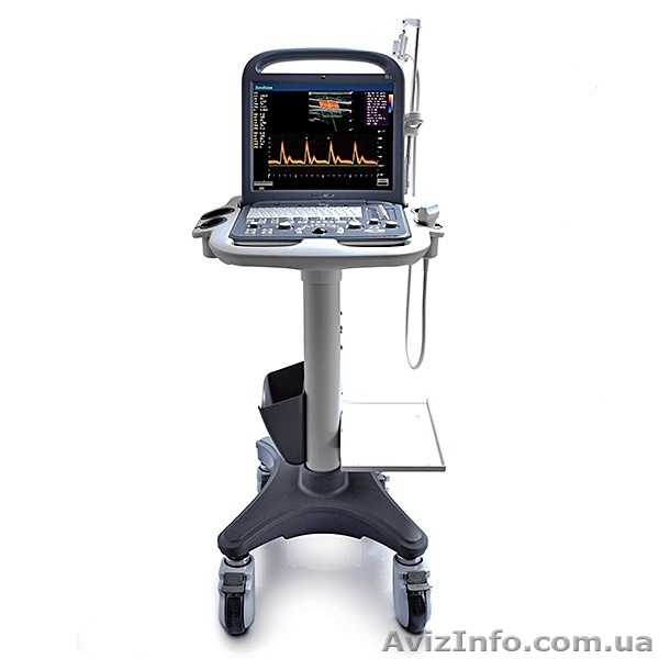 Ультразвуковой сканер SonoScape S2 - <ro>Изображение</ro><ru>Изображение</ru> #1, <ru>Объявление</ru> #1181666