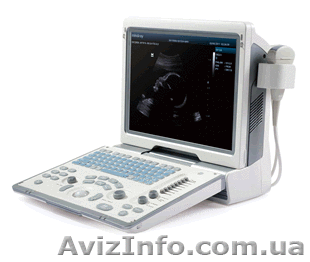 Портативный УЗ Mindray DP-50 - <ro>Изображение</ro><ru>Изображение</ru> #1, <ru>Объявление</ru> #1206932