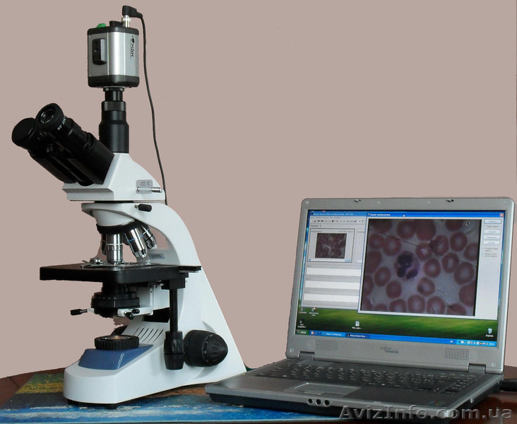 Современная диагностика организма - гемосканирование - <ro>Изображение</ro><ru>Изображение</ru> #1, <ru>Объявление</ru> #1444670