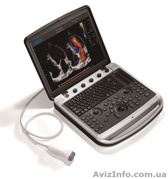Аппарат УЗИ Chison SonoBook 9 с двумя датчиками - <ro>Изображение</ro><ru>Изображение</ru> #1, <ru>Объявление</ru> #1618406