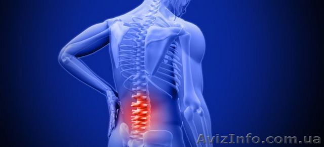 Лечение грыжи поясницы. Многолетний опыт врачей ! - <ro>Изображение</ro><ru>Изображение</ru> #1, <ru>Объявление</ru> #1636447