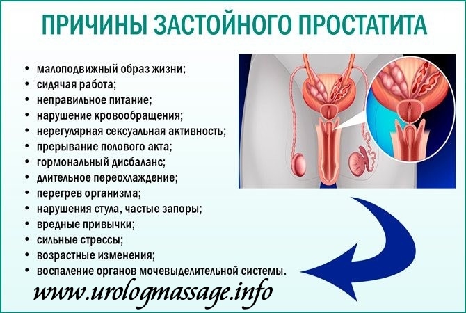 Массаж для Настоящих Мужчин Урологический массаж - <ro>Изображение</ro><ru>Изображение</ru> #1, <ru>Объявление</ru> #1742880