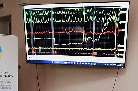 Офіційні дистанційні курси поліграфологів - <ro>Изображение</ro><ru>Изображение</ru> #1, <ru>Объявление</ru> #1753930