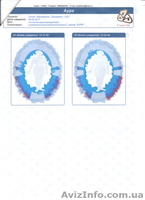 компьютерную диагностику Нейро-Оберон - <ro>Изображение</ro><ru>Изображение</ru> #3, <ru>Объявление</ru> #279526