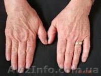 омоложение кожи лица и тела - <ro>Изображение</ro><ru>Изображение</ru> #5, <ru>Объявление</ru> #395833