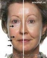 омоложение кожи лица и тела - <ro>Изображение</ro><ru>Изображение</ru> #7, <ru>Объявление</ru> #395833