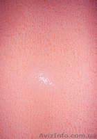 Декоративные штукатурки Киев - <ro>Изображение</ro><ru>Изображение</ru> #5, <ru>Объявление</ru> #472955