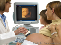 узи аппараты esaote MyLab 70 - <ro>Изображение</ro><ru>Изображение</ru> #5, <ru>Объявление</ru> #566570