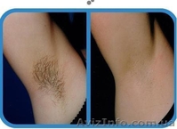 Восковая профессиональная депиляция воском.метро Лукяновка  - <ro>Изображение</ro><ru>Изображение</ru> #1, <ru>Объявление</ru> #887906