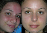 24 часа и ваша кожа сияет!Иначе мы вернем вам деньги - <ro>Изображение</ro><ru>Изображение</ru> #2, <ru>Объявление</ru> #898573