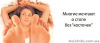 Лечение "косточек" (шишек) на ногах без операции - <ro>Изображение</ro><ru>Изображение</ru> #1, <ru>Объявление</ru> #910324