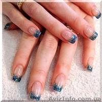 Наращивание ногтей Киев на Голосеево - <ro>Изображение</ro><ru>Изображение</ru> #3, <ru>Объявление</ru> #1315322