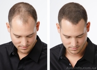 Загуститель Волос Toppik Большой 25г - <ro>Изображение</ro><ru>Изображение</ru> #2, <ru>Объявление</ru> #1547322