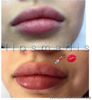 Увеличение, коррекция губ  - <ro>Изображение</ro><ru>Изображение</ru> #2, <ru>Объявление</ru> #1632127