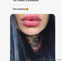 Увеличение, коррекция губ  - <ro>Изображение</ro><ru>Изображение</ru> #3, <ru>Объявление</ru> #1632127