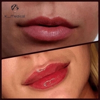 Врач косметолог в Киеве. - <ro>Изображение</ro><ru>Изображение</ru> #1, <ru>Объявление</ru> #1669426