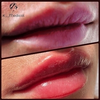 Врач косметолог в Киеве. - <ro>Изображение</ro><ru>Изображение</ru> #2, <ru>Объявление</ru> #1669426