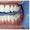 Профессиональное аппаратное отбеливание зубов Beyond #1268547