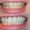 Профессиональное аппаратное отбеливание зубов Beyond - <ro>Изображение</ro><ru>Изображение</ru> #2, <ru>Объявление</ru> #1268547