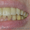 Имплантация при полной потере зубов - <ro>Изображение</ro><ru>Изображение</ru> #3, <ru>Объявление</ru> #1276285