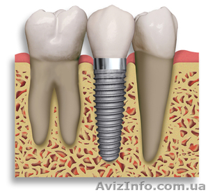Импластика  частная стоматологическая клиника