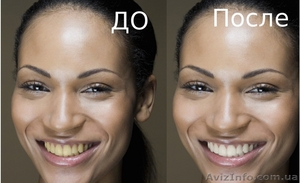 Отбеливающий гель для зубов - <ro>Изображение</ro><ru>Изображение</ru> #3, <ru>Объявление</ru> #804050