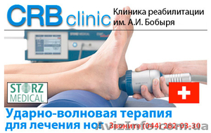 Ударно-волновая терапия для лечения ног - <ro>Изображение</ro><ru>Изображение</ru> #1, <ru>Объявление</ru> #937797