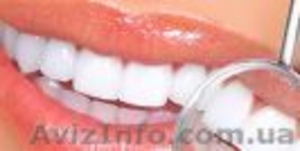 Отбеливающая зубная паста CREST 3D WHITE Fluoride Anticavity 164грамма - <ro>Изображение</ro><ru>Изображение</ru> #2, <ru>Объявление</ru> #738225