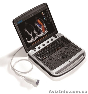 Аппарат УЗИ Chison SonoBook 9 с двумя датчиками - <ro>Изображение</ro><ru>Изображение</ru> #1, <ru>Объявление</ru> #1618406