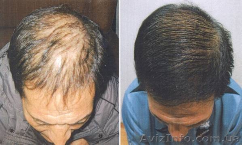 Шикарные волосы - это просто! - <ro>Изображение</ro><ru>Изображение</ru> #1, <ru>Объявление</ru> #7756