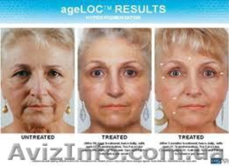 омоложение кожи лица и тела - <ro>Изображение</ro><ru>Изображение</ru> #3, <ru>Объявление</ru> #395833