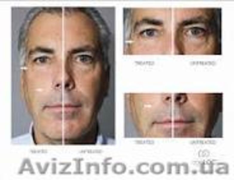 омоложение кожи лица и тела - <ro>Изображение</ro><ru>Изображение</ru> #2, <ru>Объявление</ru> #395833