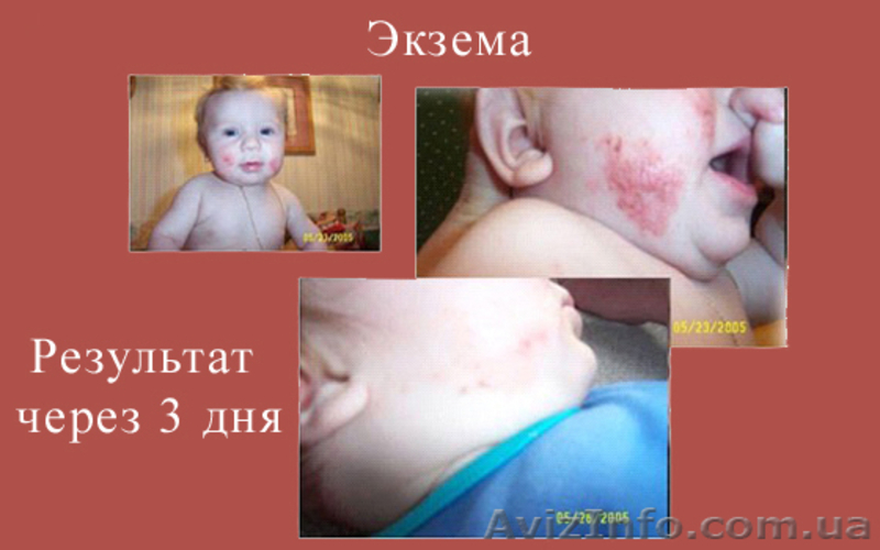 ЛЕЧЕБНАЯ ИНТУИТИВНАЯ НАТУРАЛЬНАЯ КОСМЕТИКА "GLIMPSE" - <ro>Изображение</ro><ru>Изображение</ru> #4, <ru>Объявление</ru> #454532