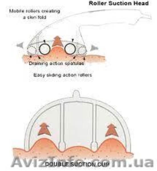 Вакуумно-роликовый массажер "Starvac SP Original"  - <ro>Изображение</ro><ru>Изображение</ru> #2, <ru>Объявление</ru> #509085