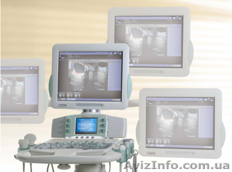 узи аппараты esaote MyLab 70 - <ro>Изображение</ro><ru>Изображение</ru> #3, <ru>Объявление</ru> #566570