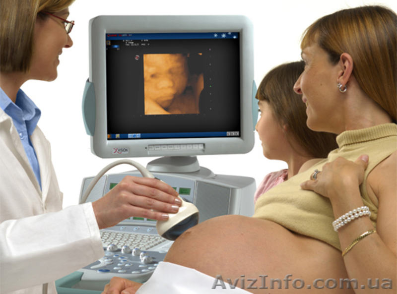 узи аппараты esaote MyLab 70 - <ro>Изображение</ro><ru>Изображение</ru> #5, <ru>Объявление</ru> #566570