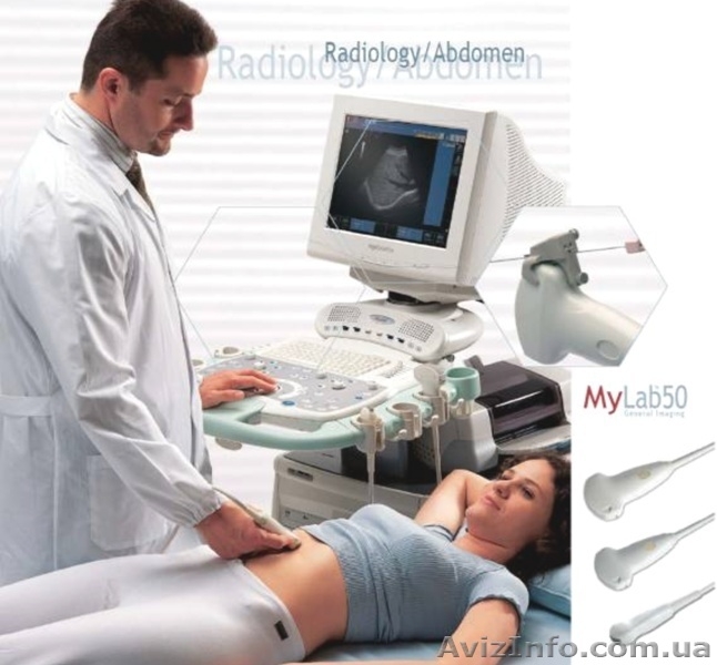Продаю УЗИ аппараты производства Япония и Италия - <ro>Изображение</ro><ru>Изображение</ru> #3, <ru>Объявление</ru> #785728
