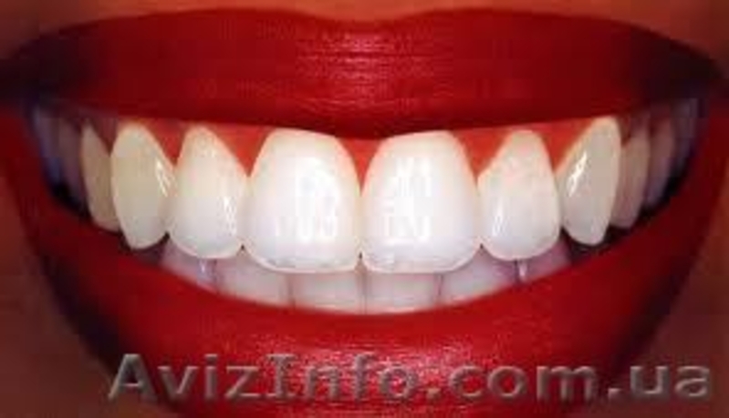 Отбеливающий гель для зубов - <ro>Изображение</ro><ru>Изображение</ru> #2, <ru>Объявление</ru> #804050