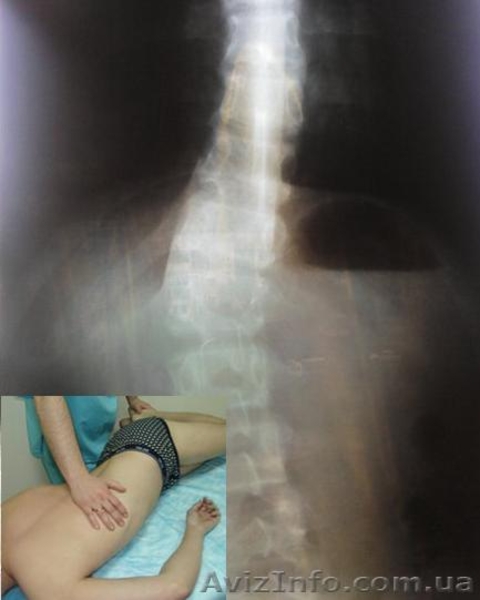 Мануальная терапия на дом в офис  - <ro>Изображение</ro><ru>Изображение</ru> #3, <ru>Объявление</ru> #828567