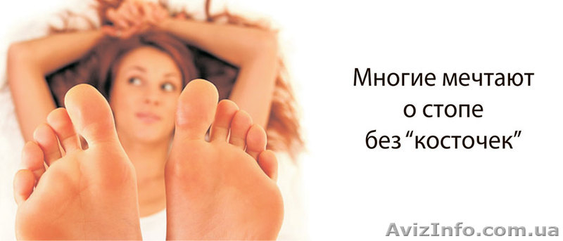 Лечение "косточек" (шишек) на ногах без операции - <ro>Изображение</ro><ru>Изображение</ru> #1, <ru>Объявление</ru> #910324